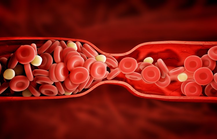 Seniors and Blood Clots: What are the Symptoms?-Image